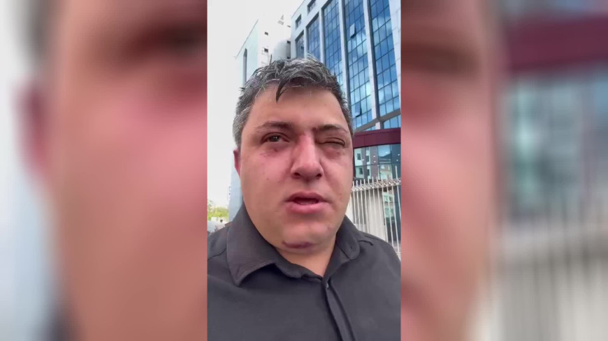 Altındağ Belediyesi personeli Erdoğan, Altındağ Belediye Başkanı Tiryaki ve yardımcıları tarafından darp edildiğini ileri sürdü: ''20 dakika darba maruz kaldım''