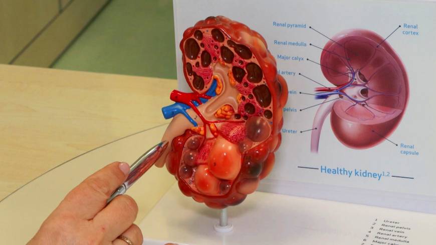 ‘Böbrek hastalıkları sessizce ilerliyor: Erken teşhis için düzenli kontrol hayat kurtarıyor’