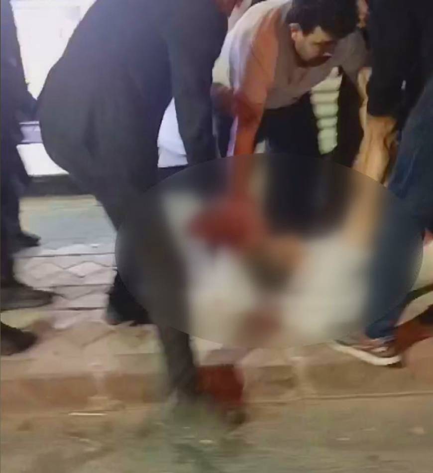 İstanbul- Sultangazi'de düğün salonunda bıçaklı kavga: 2 yaralı, 3 gözaltı
