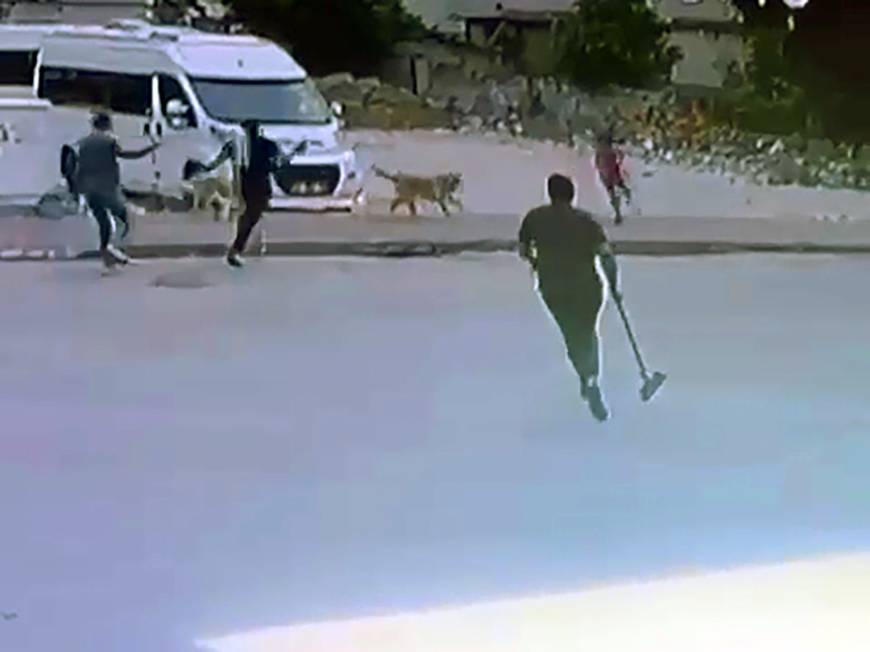 Sokak köpeklerinin saldırdığı çocuğu esnaf kurtardı