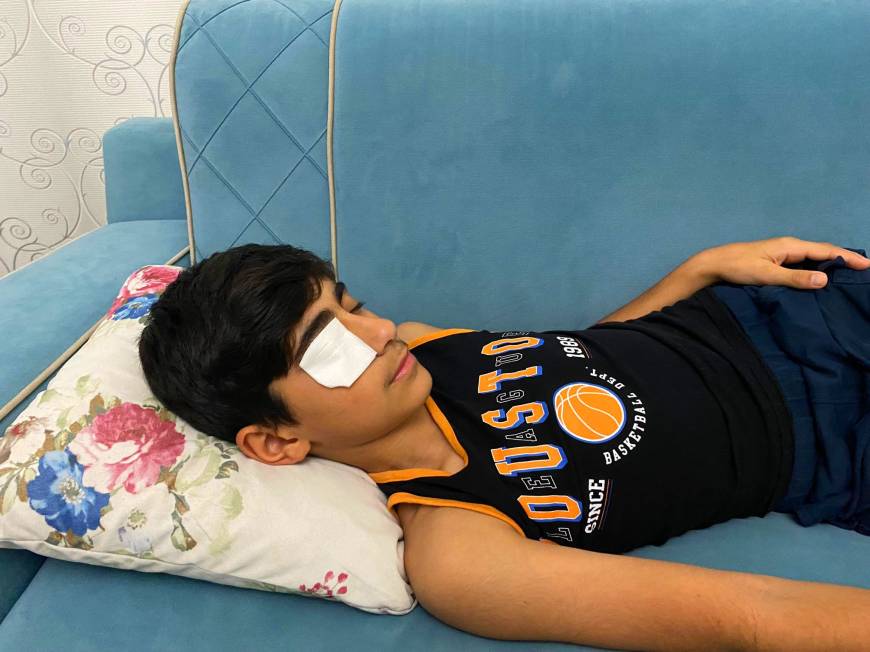 Yapıştırıcı sıçrayınca kapanan göz kapağı doktor müdahalesiyle açıldı