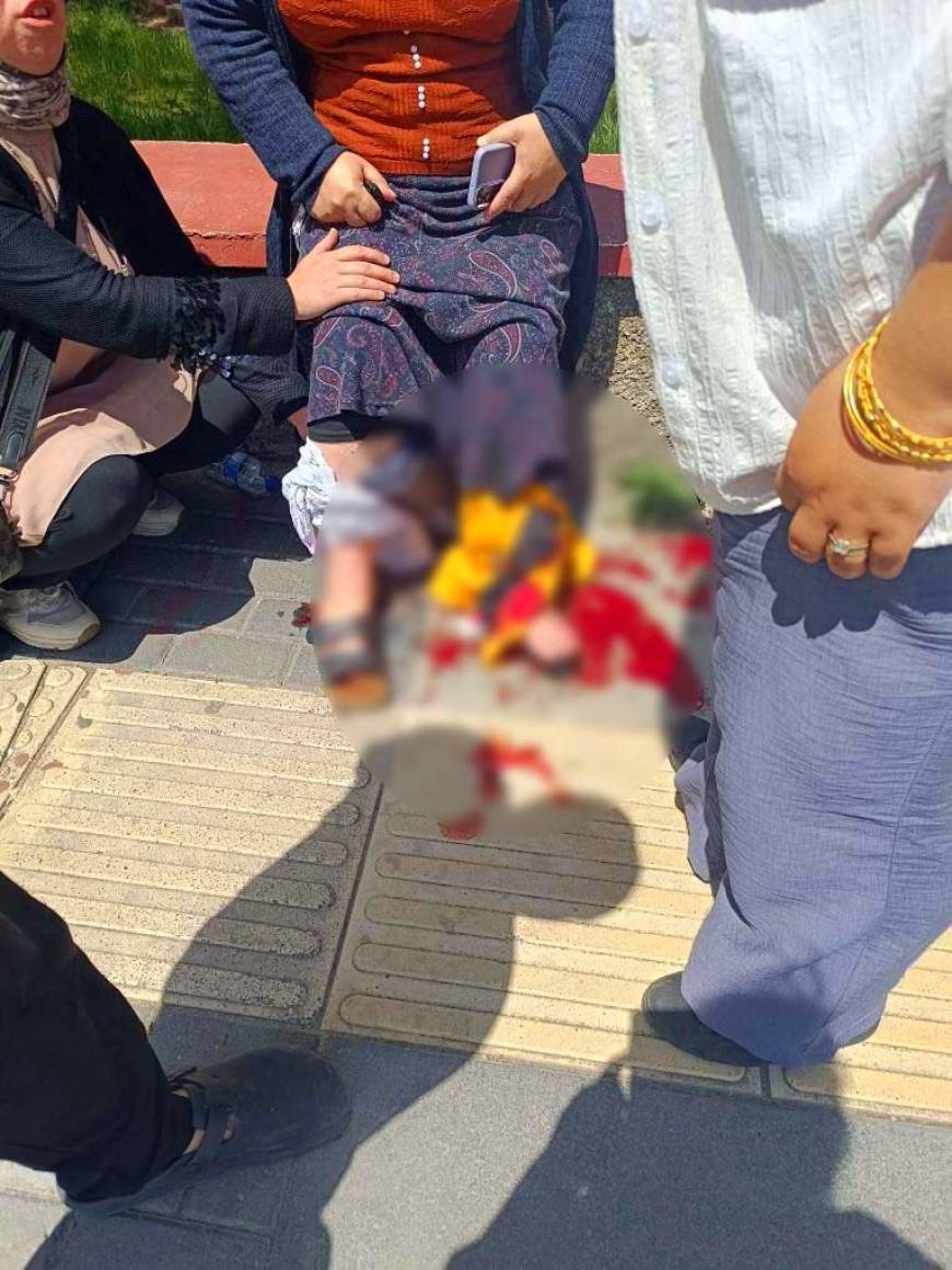 Husumetlilerin silahlı kavgasında yoldan geçen kadın bacağından vuruldu